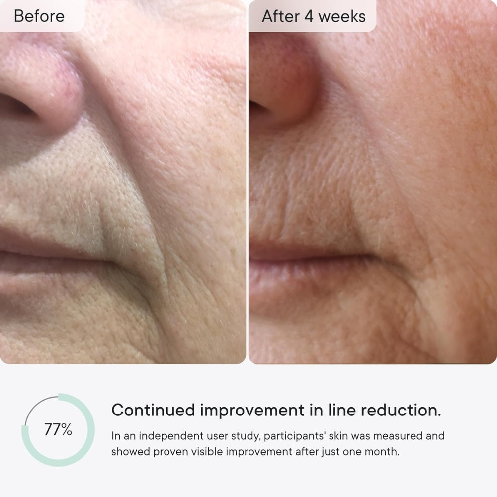 Mirora™ – Micro-Infusion Anti-Wrinkle Patches