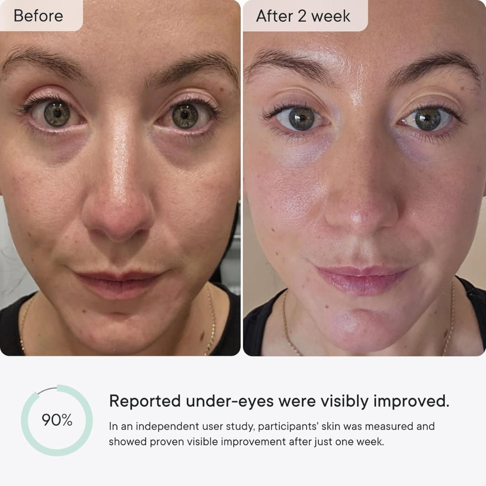 Mirora™ – Micro-Infusion Anti-Wrinkle Patches